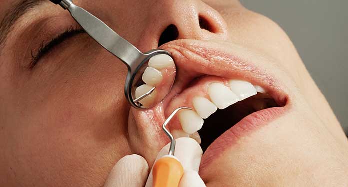 Ultrasound holds promise of accurate, risk-free diagnosis of dental disease