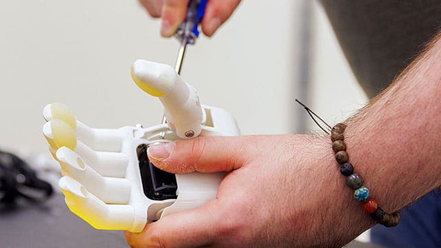 AI is revolutionizing prosthetics